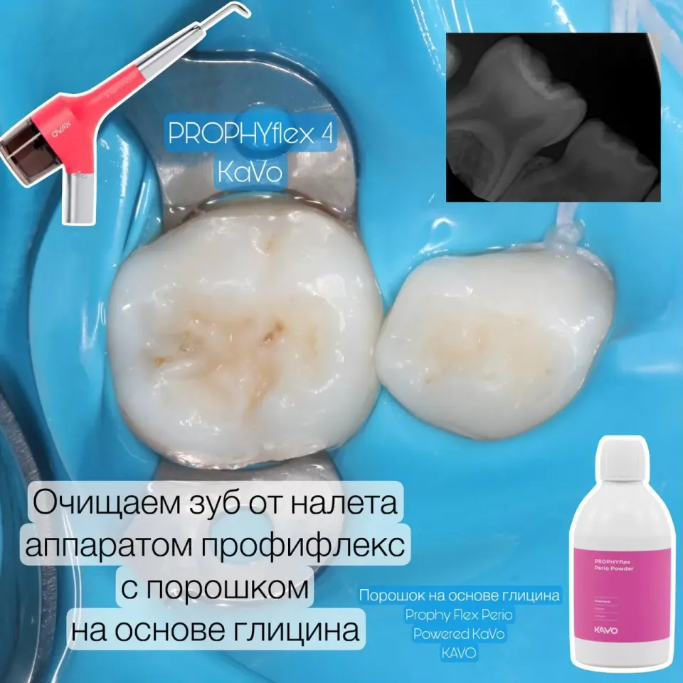 Фото из поста