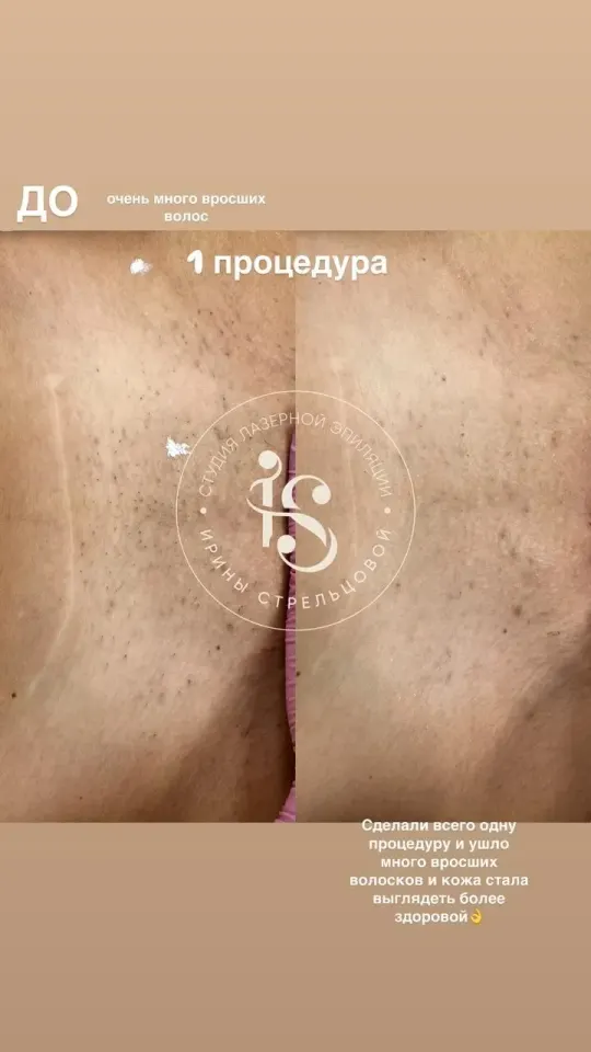Фото из поста
