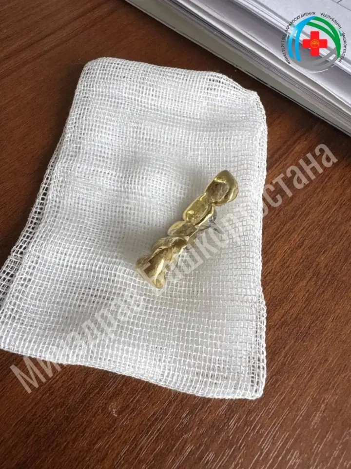 Фото из поста