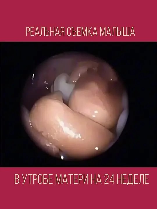 Обложка видео