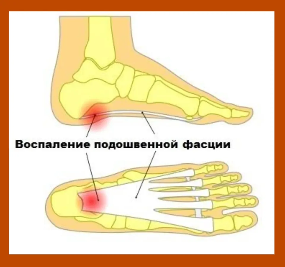 Фото из поста
