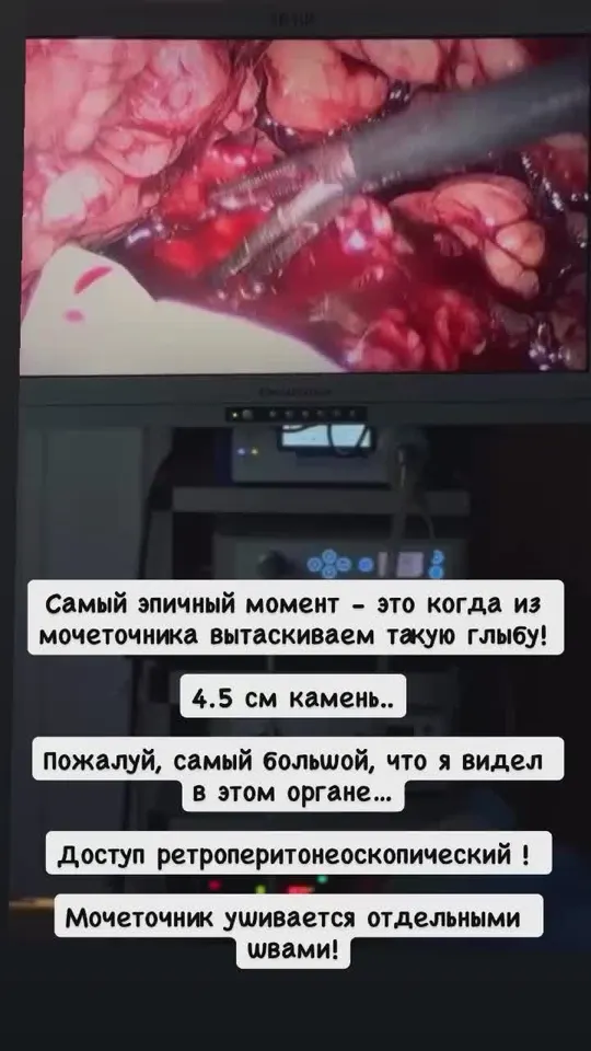 Обложка видео