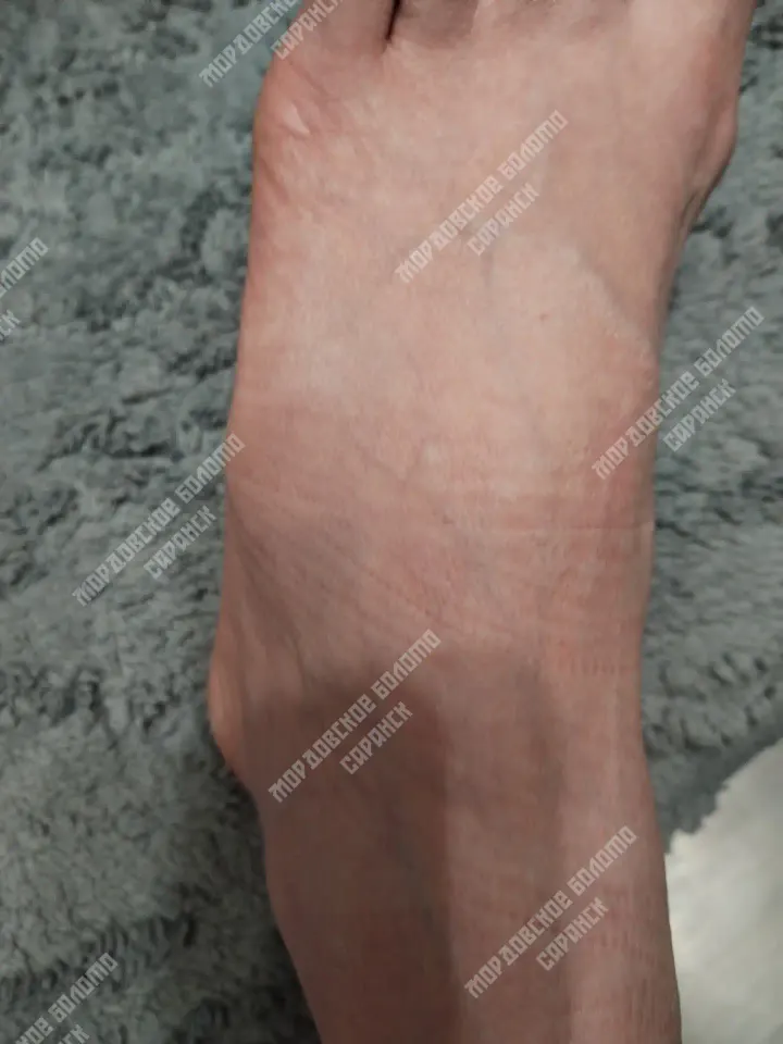 Фото из поста