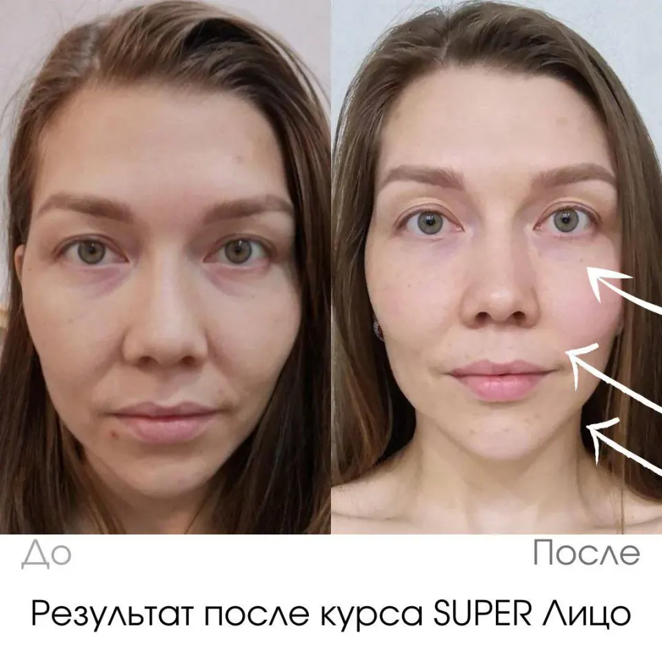 Фото из поста